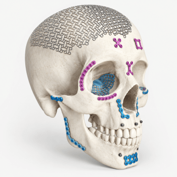 HC <br>  Craniomaxillofacial (CMF)