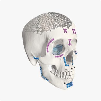 Craniomaxillofacial<br> (CMF)