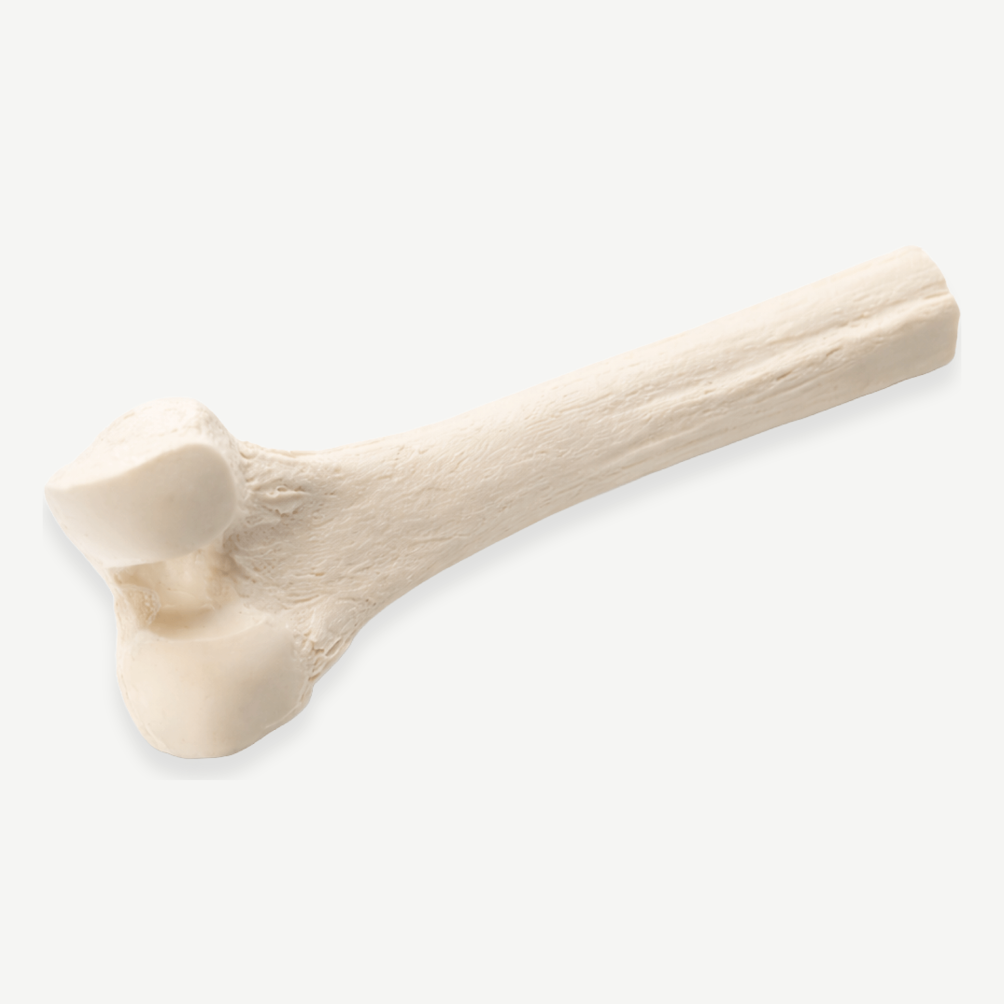 HC Biologics <br> Structural Allografts - Image 4