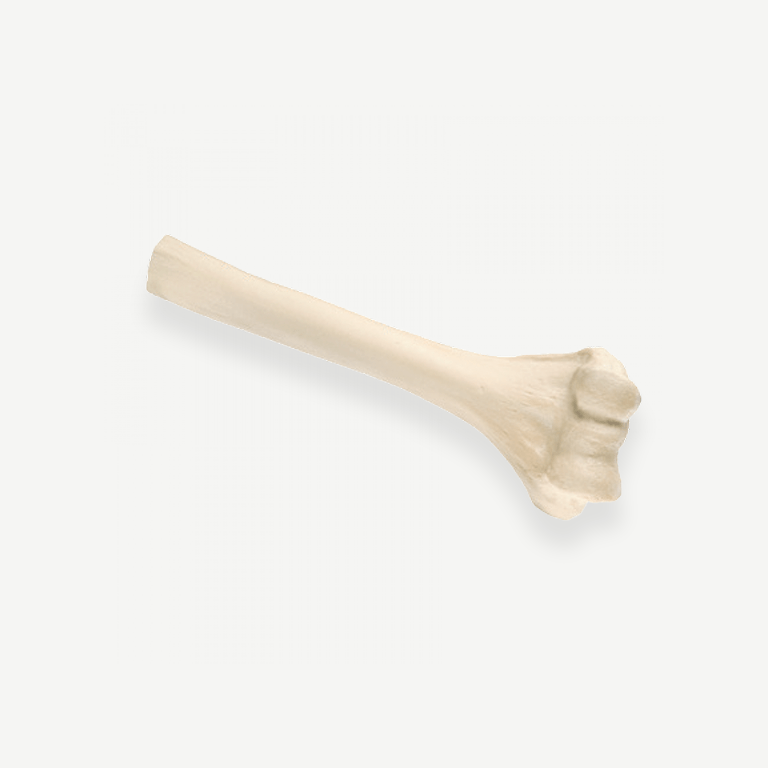 HC Biologics <br> Structural Allografts - Image 5